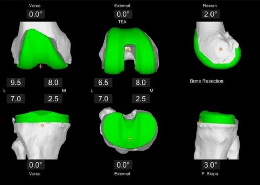 Olympia Orthopaedic Associates